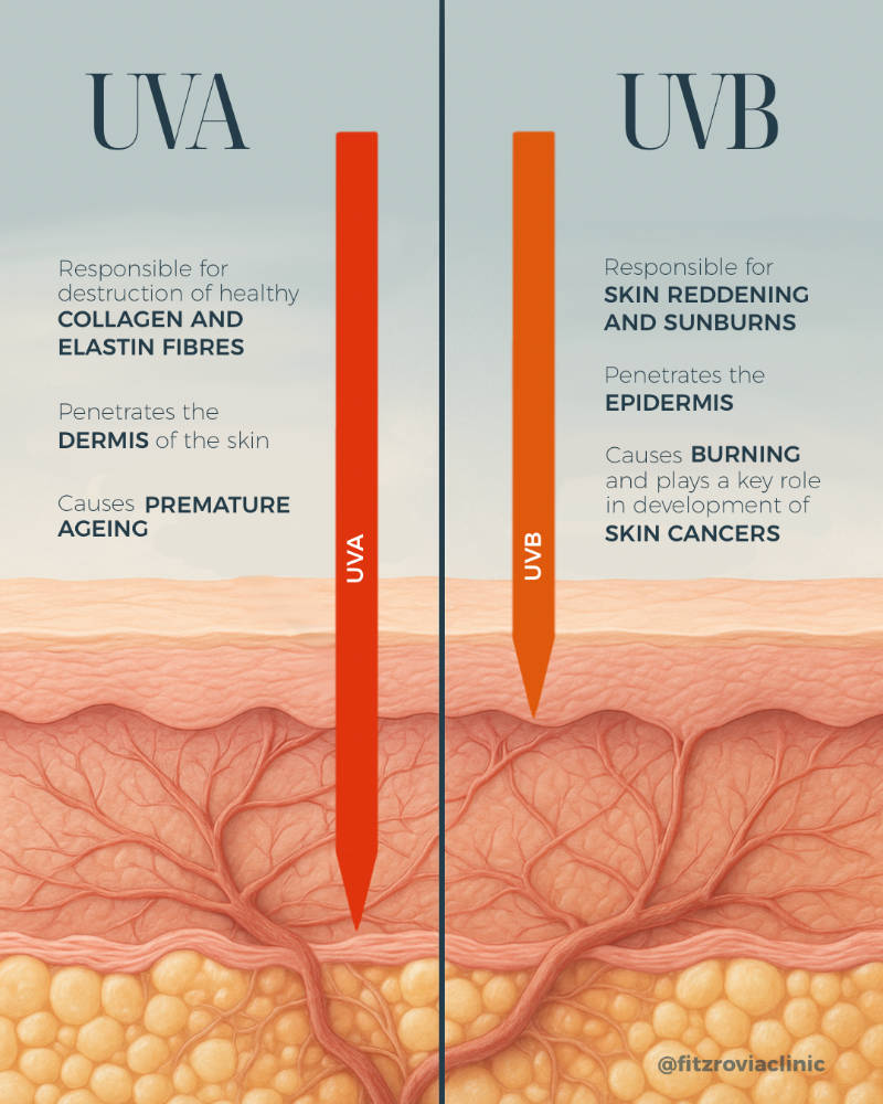 uva-vs-uvb