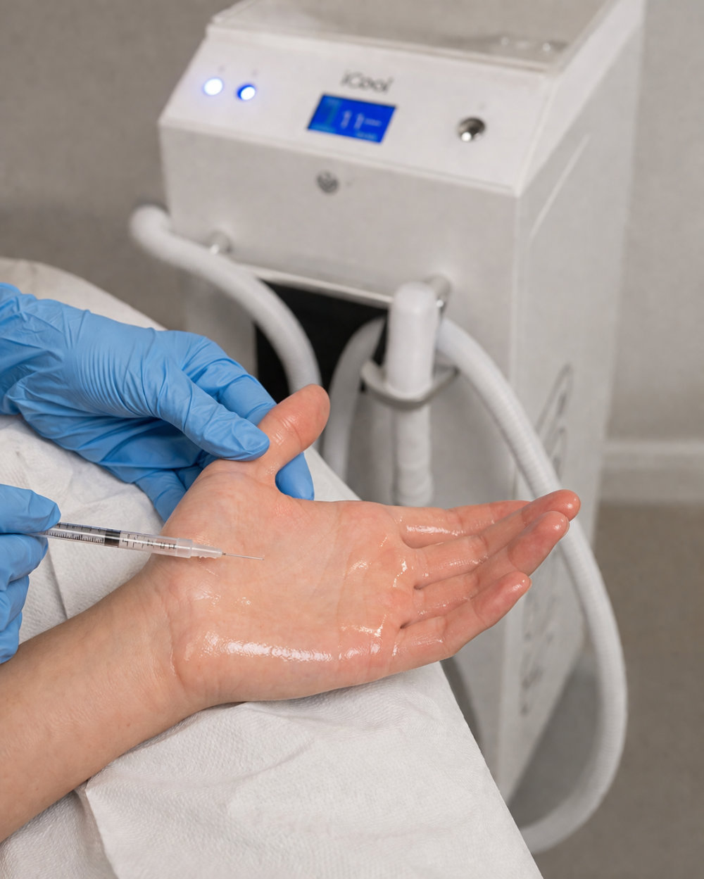 a patient having a botox injection for hyperhidrosis
